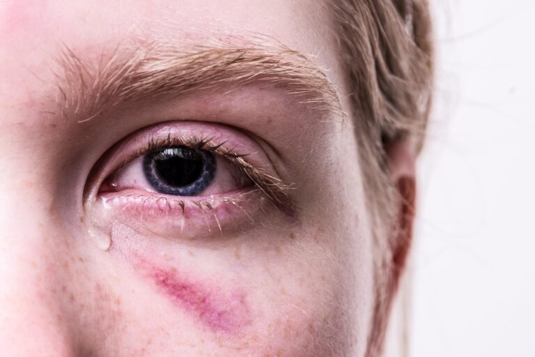 Traumatisme influence-t-il encore votre vie